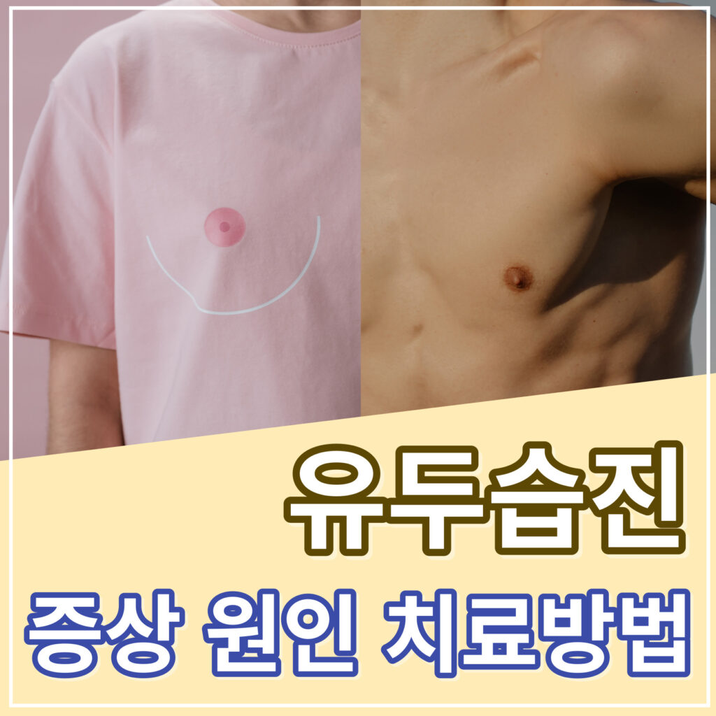 유두습진 증상 치료방법